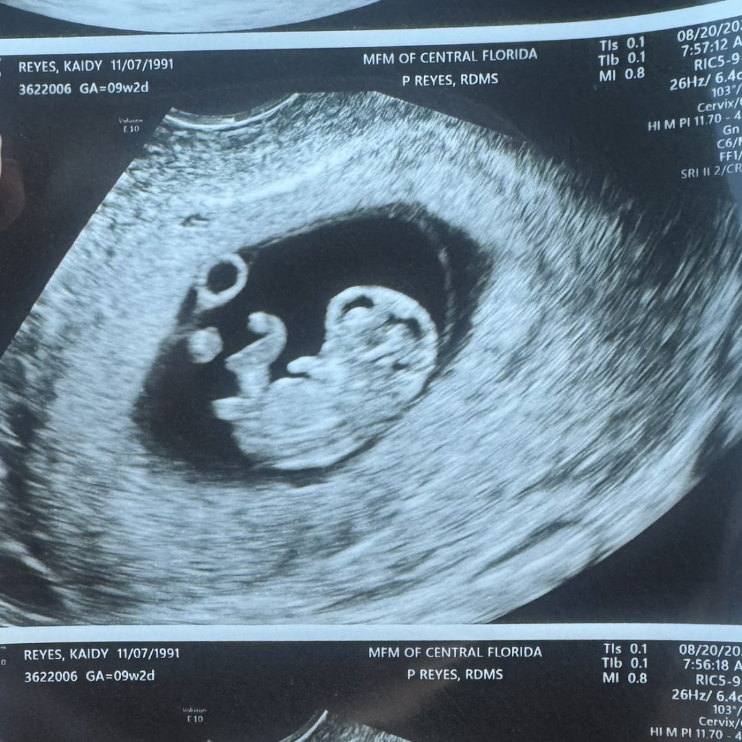 Photo shared by Kaidy for their Babylist baby registry.