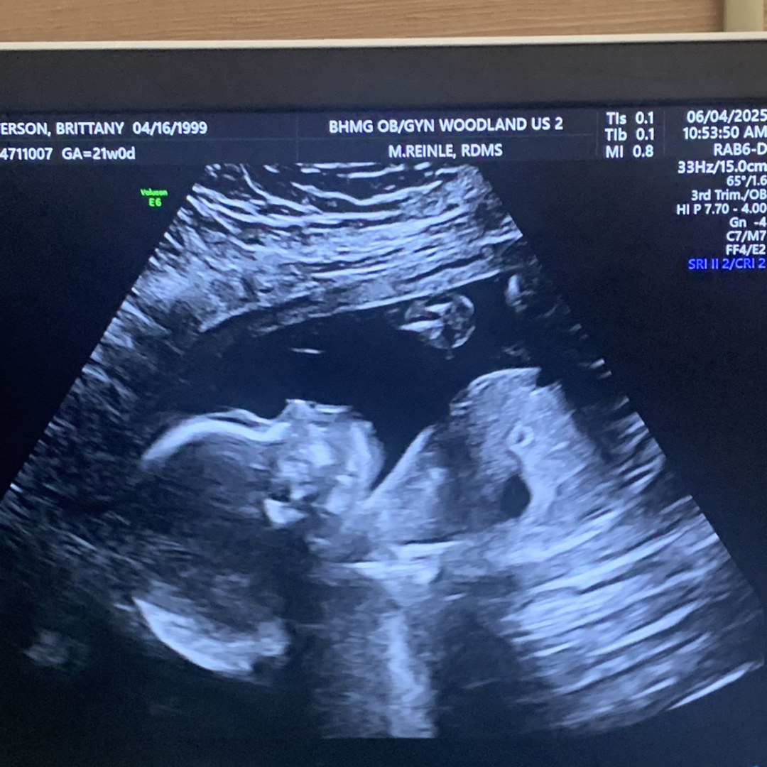 Photo shared by Brittany for their Babylist baby registry.