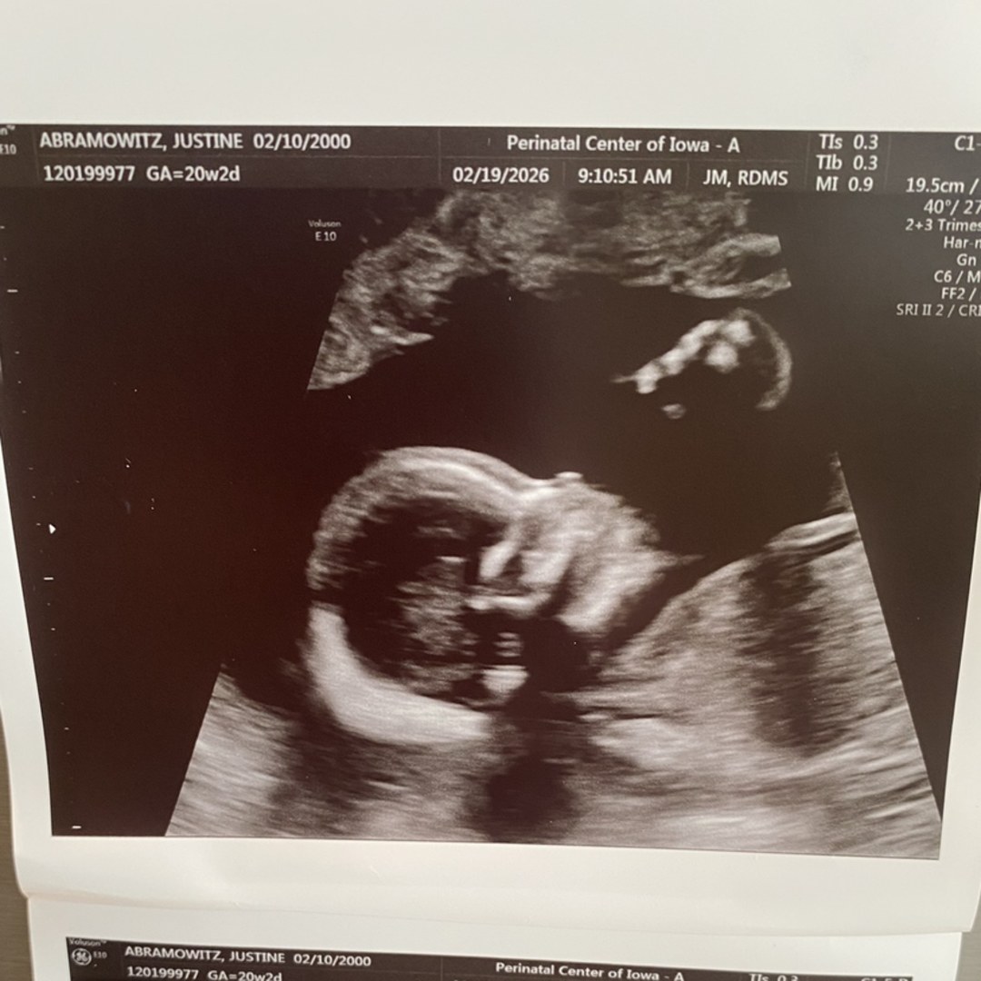 Photo shared by Justine & Grant for their Babylist baby registry.