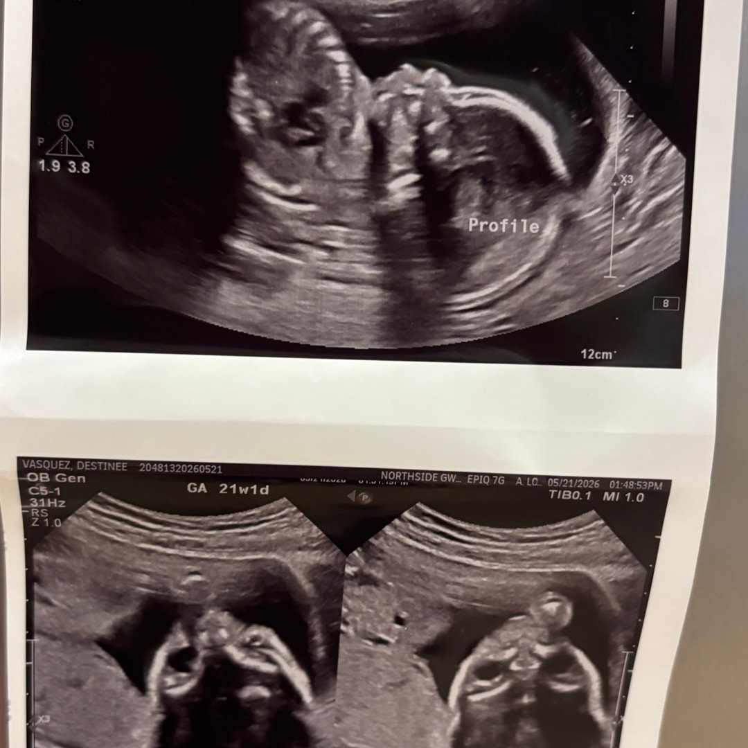 Photo shared by Destinee for their Babylist baby registry.