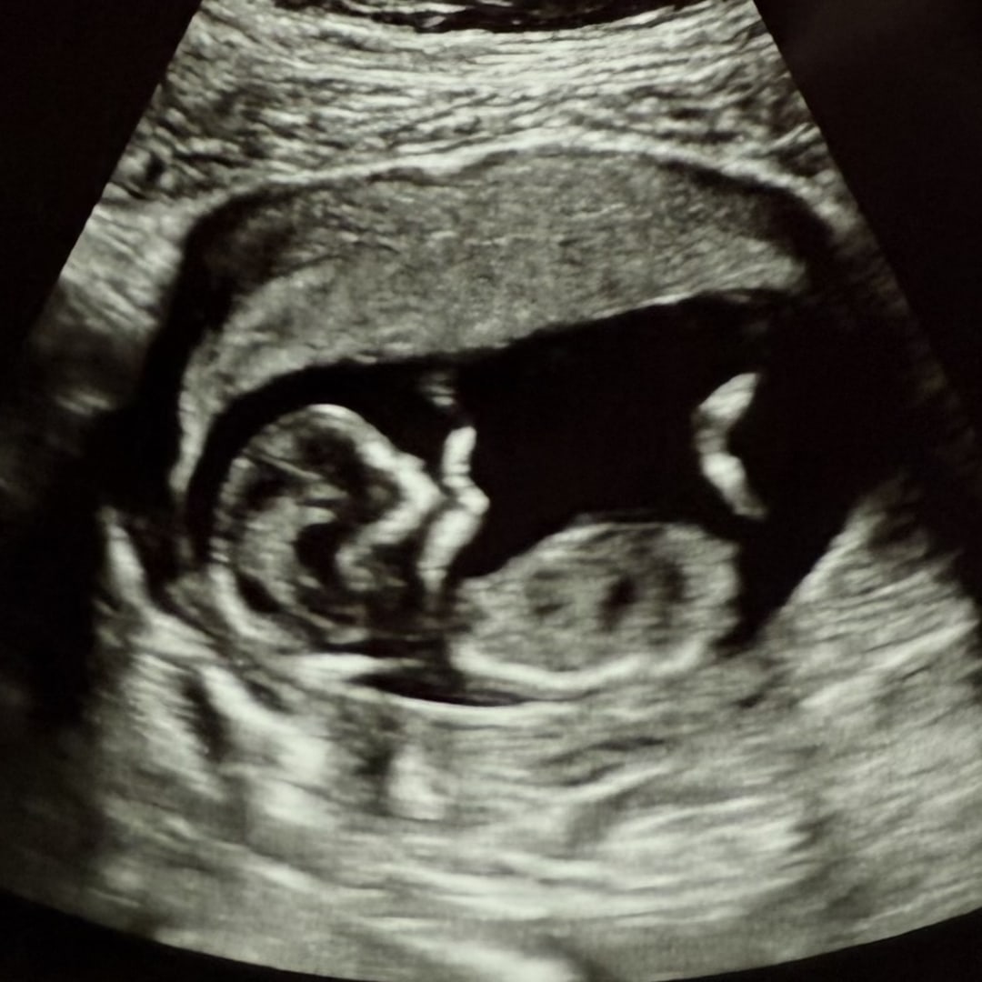 Photo shared by Maggie for their Babylist baby registry.