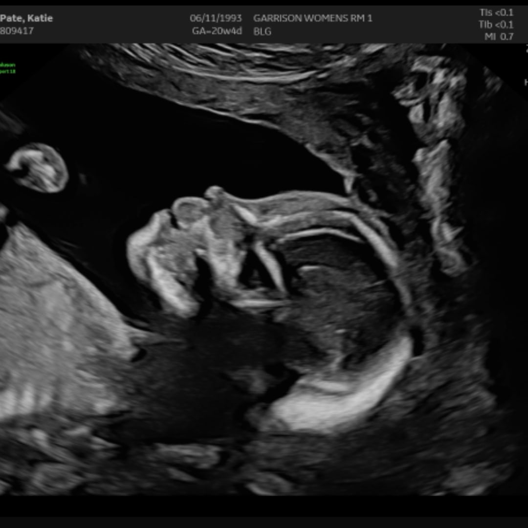 Photo shared by Katie for their Babylist baby registry.