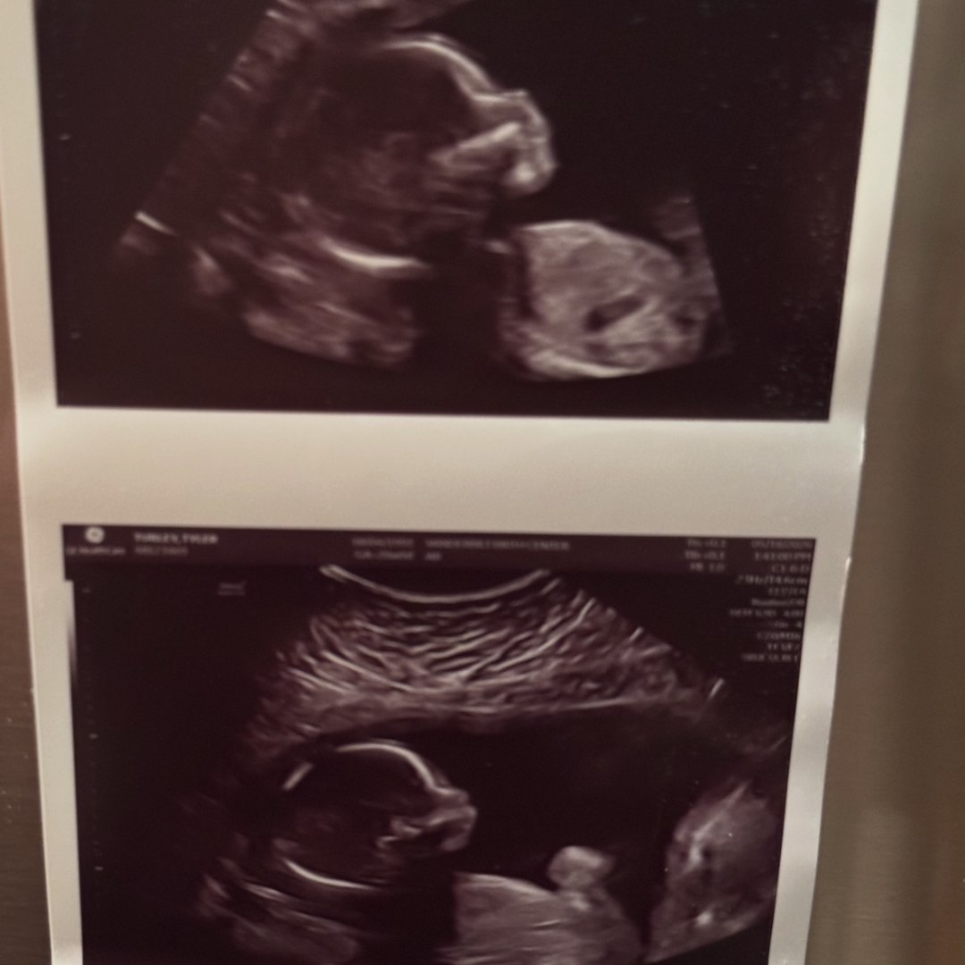 Photo shared by Tyler for their Babylist baby registry.
