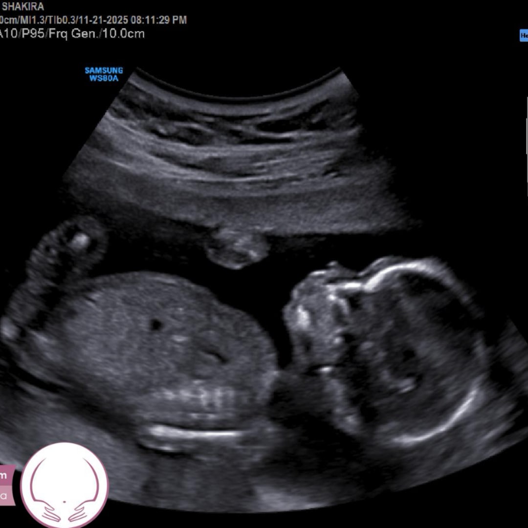 Photo shared by Shakira for their Babylist baby registry.