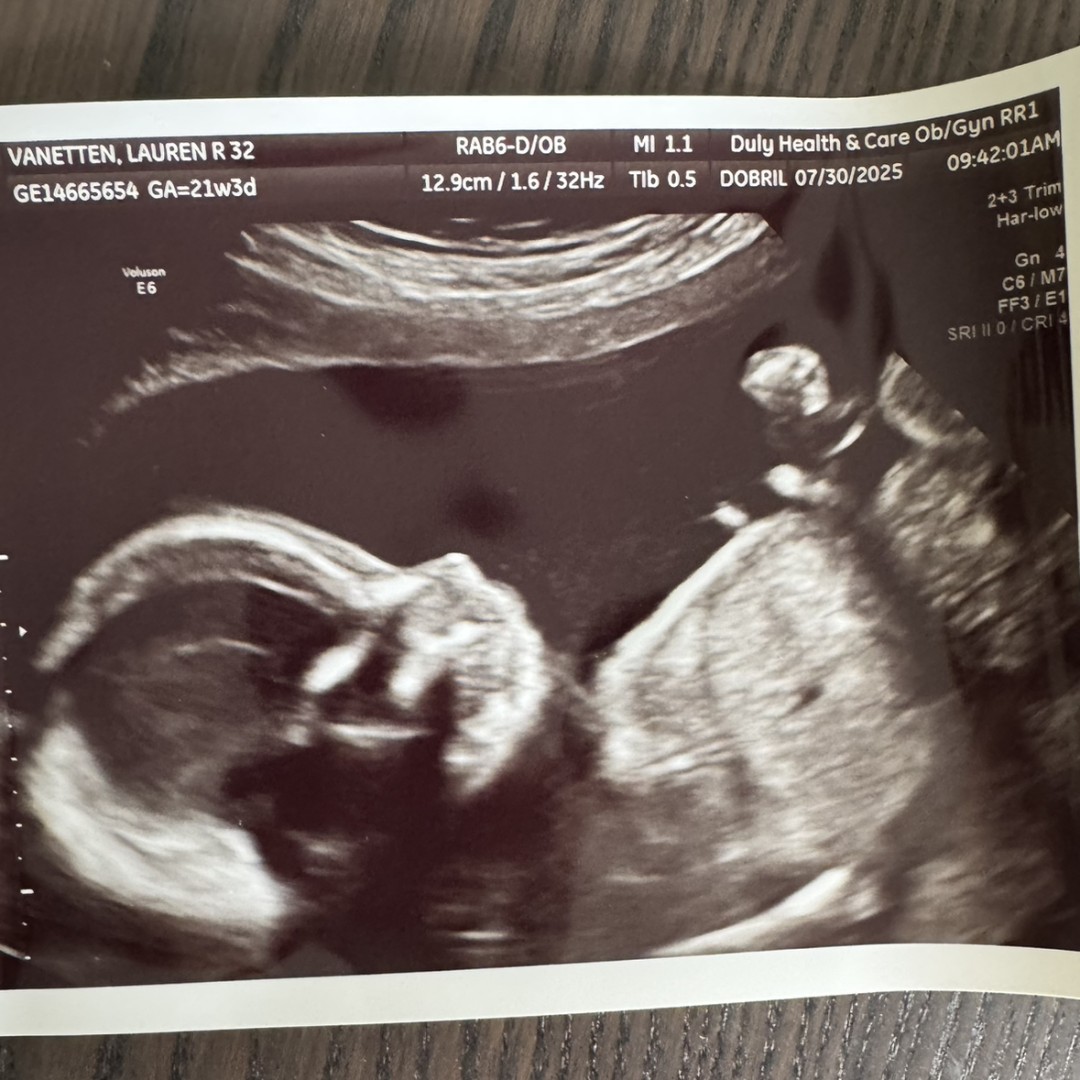 Photo shared by Lauren for their Babylist baby registry.