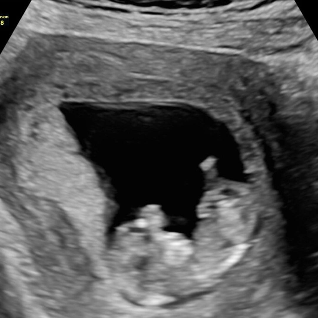 Photo shared by Cassie for their Babylist baby registry.