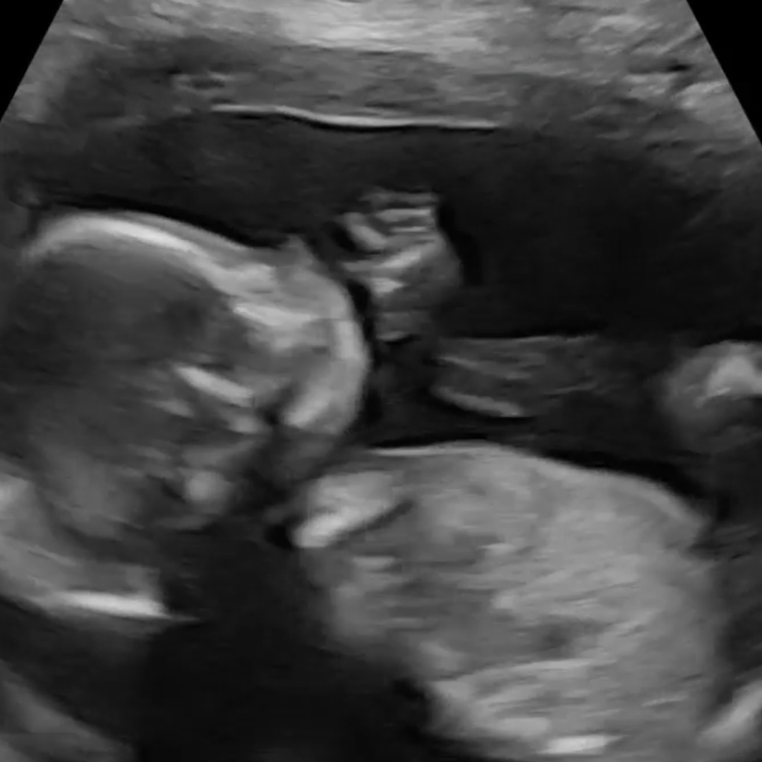 Photo shared by Kat for their Babylist baby registry.