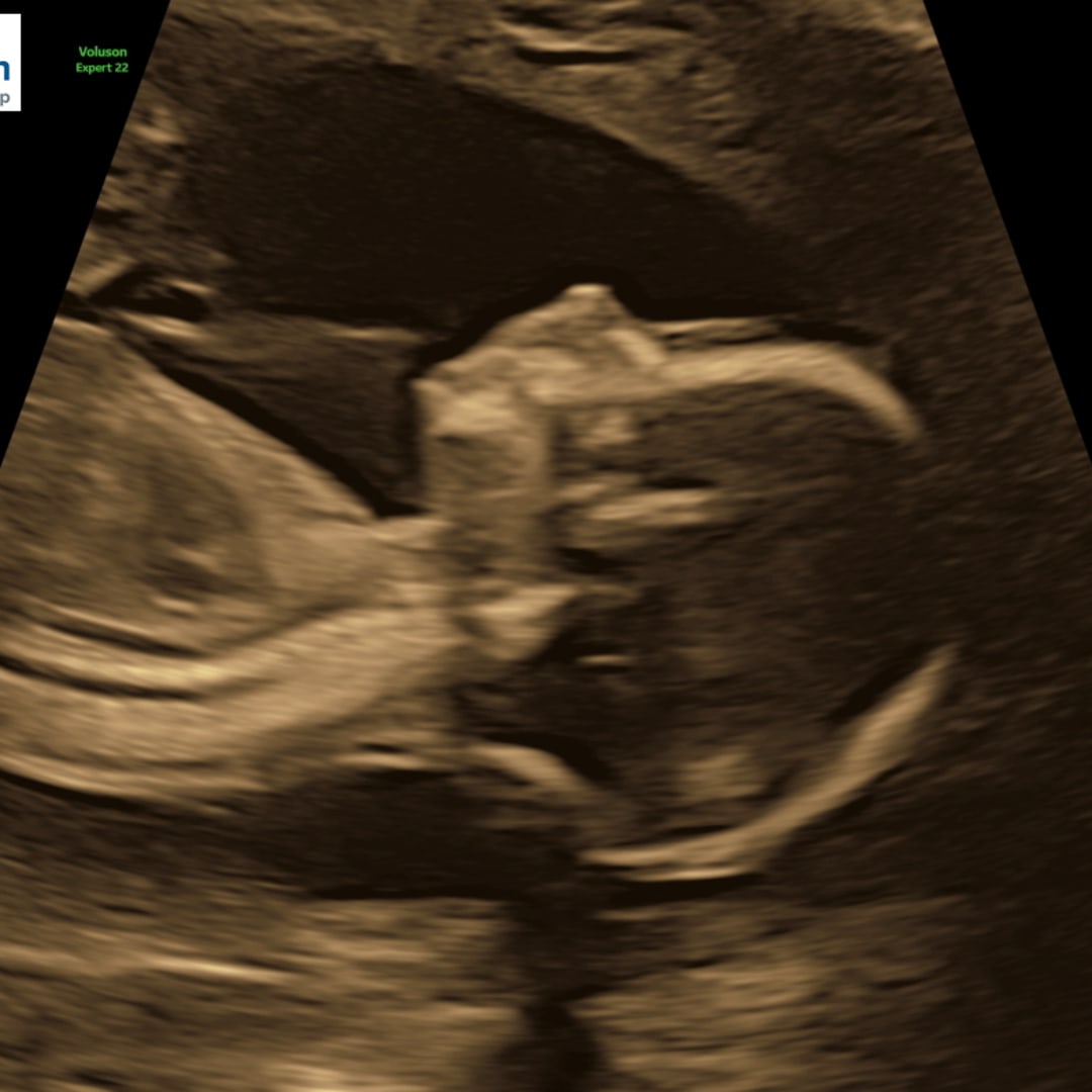 Photo shared by Megan for their Babylist baby registry.