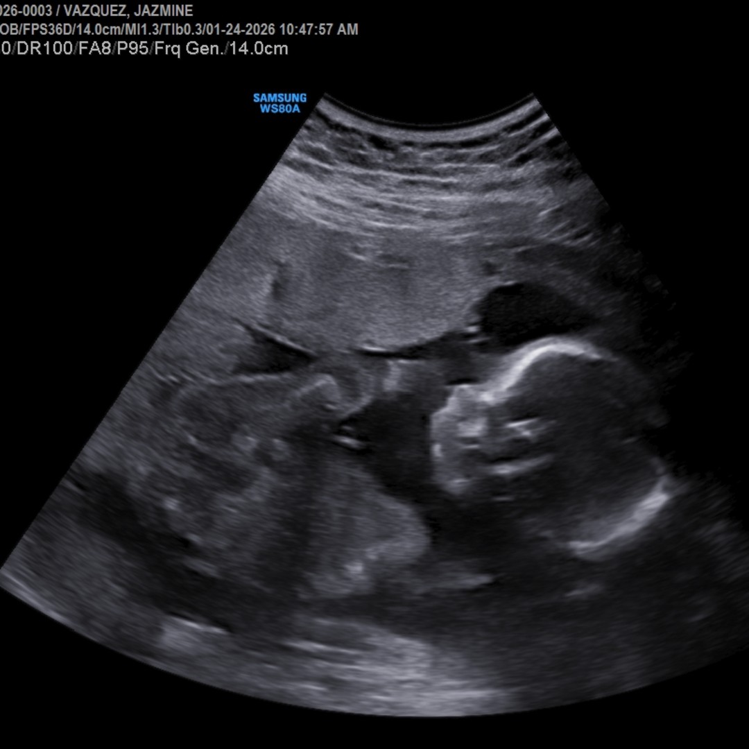 Photo shared by Jazmine for their Babylist baby registry.