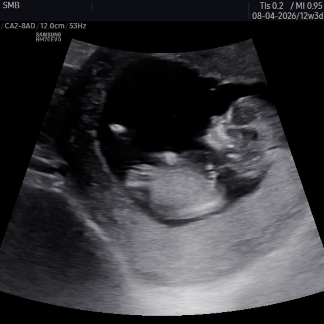 Photo shared by Kimberly for their Babylist baby registry.