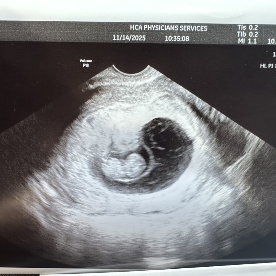 Photo shared by Hien for their Babylist baby registry.