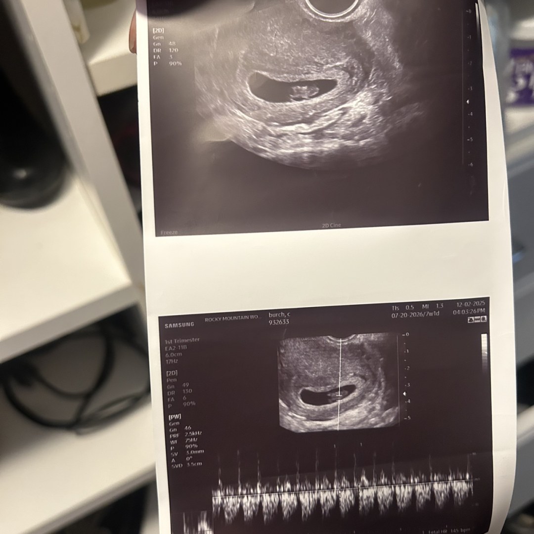 Photo shared by Elachye for their Babylist baby registry.