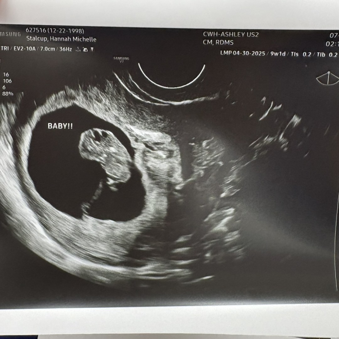 Photo shared by Hannah for their Babylist baby registry.