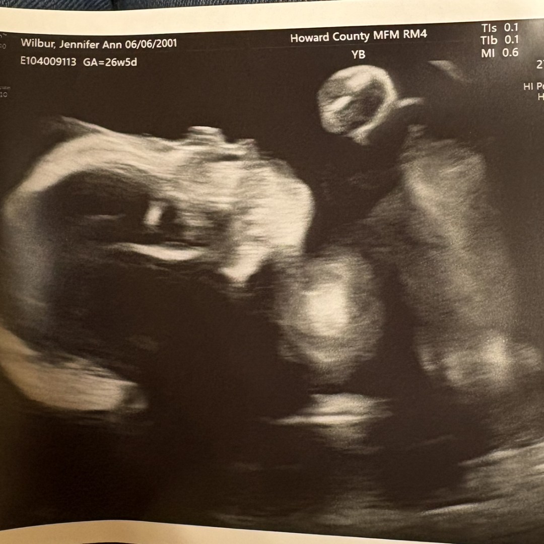 Photo shared by Jennifer for their Babylist baby registry.