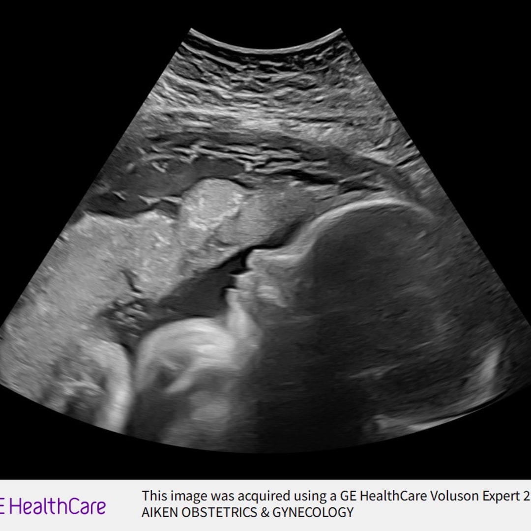 Photo shared by Katherine for their Babylist baby registry.