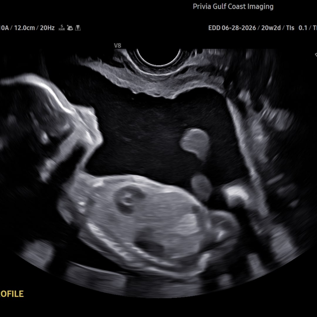 Photo shared by Becca for their Babylist baby registry.