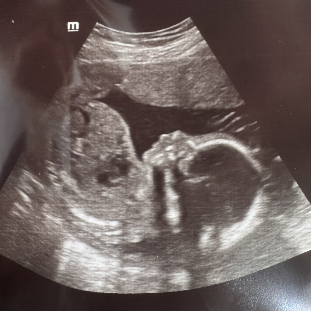 Photo shared by Siobhan for their Babylist baby registry.