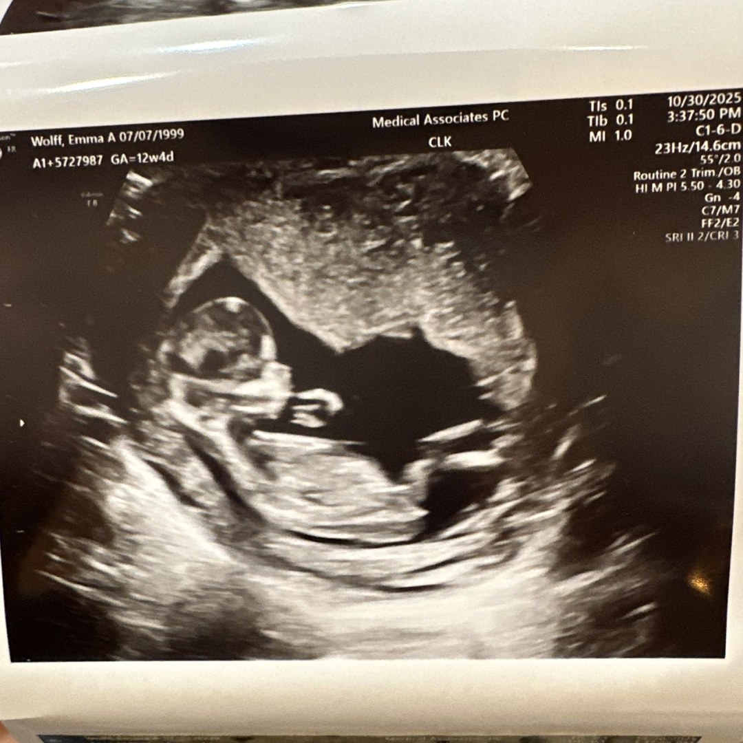 Photo shared by Emma for their Babylist baby registry.