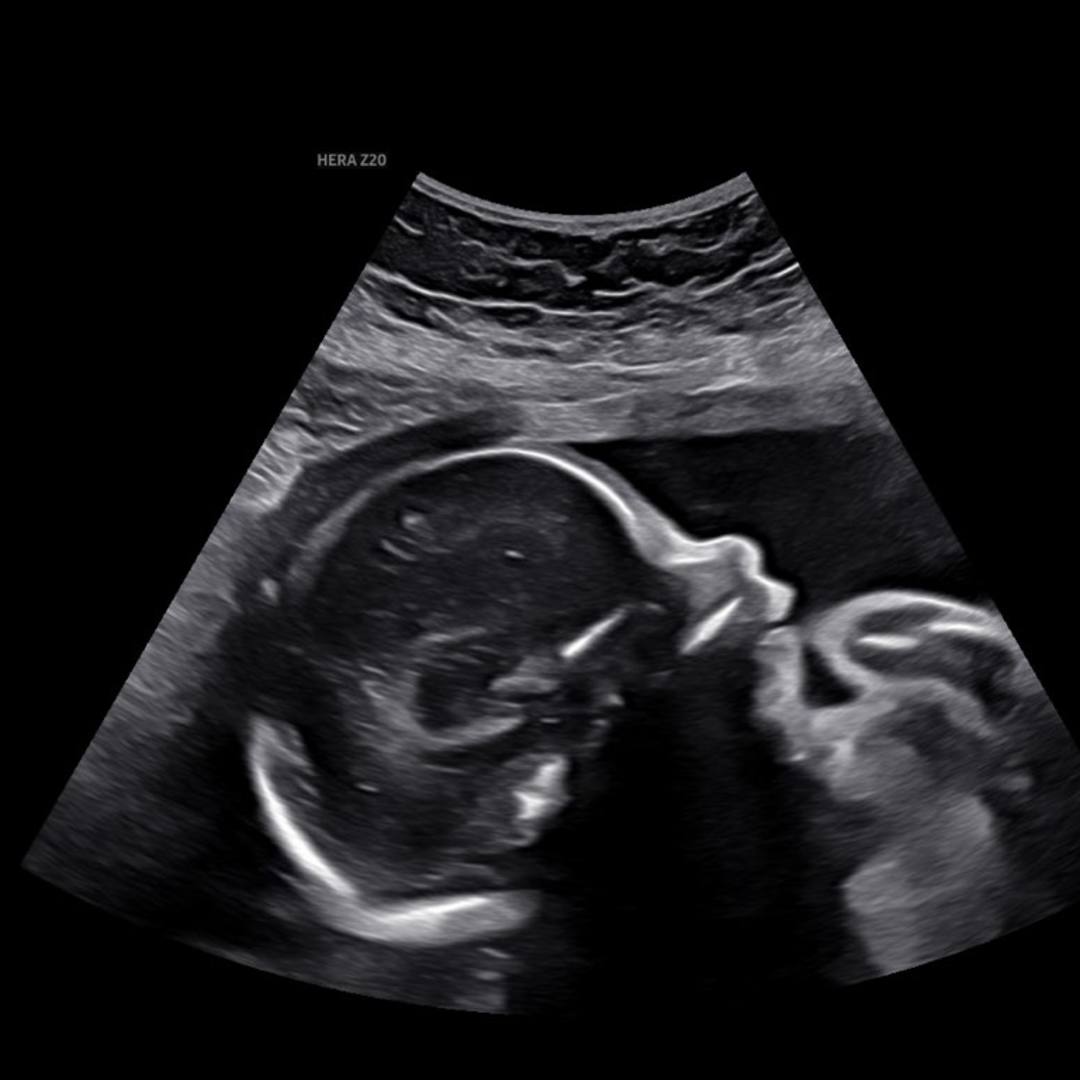 Photo shared by Charity for their Babylist baby registry.