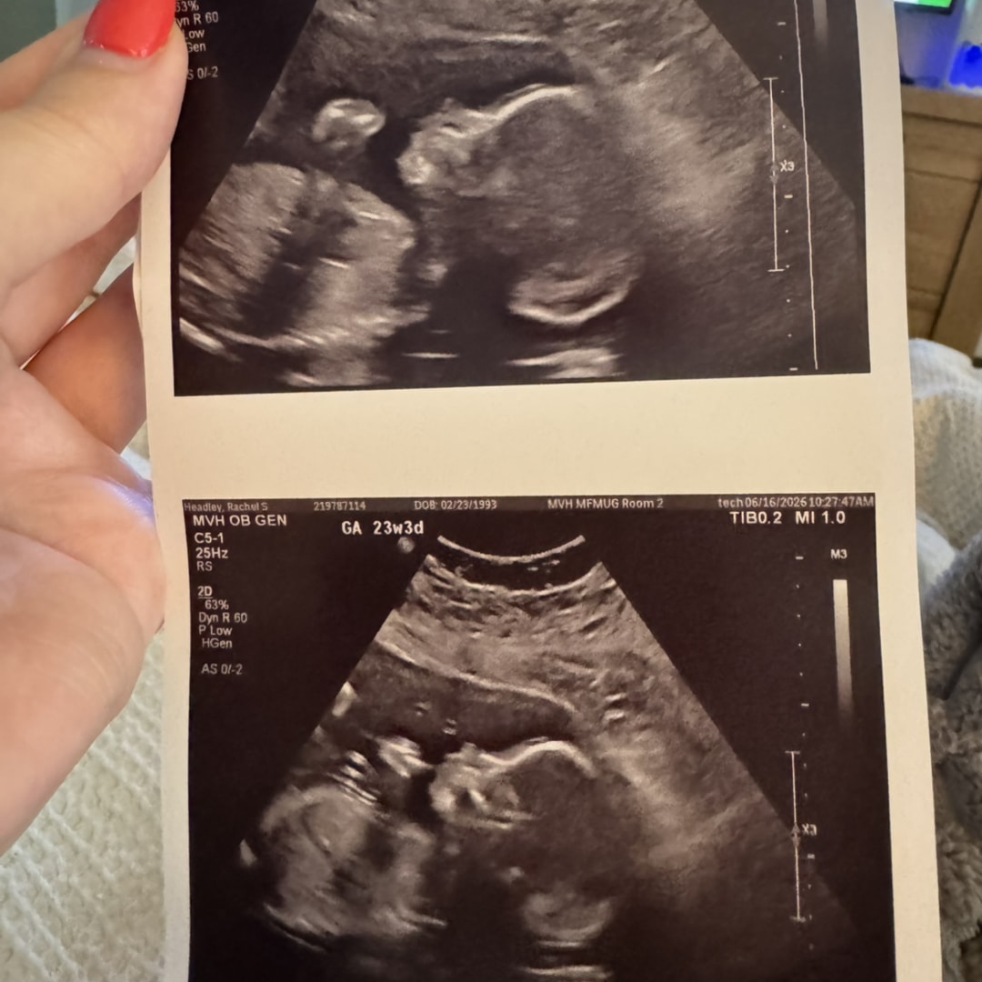 Photo shared by Rachel for their Babylist baby registry.