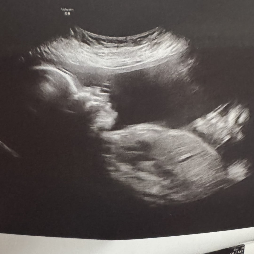 Photo shared by Chasity for their Babylist baby registry.