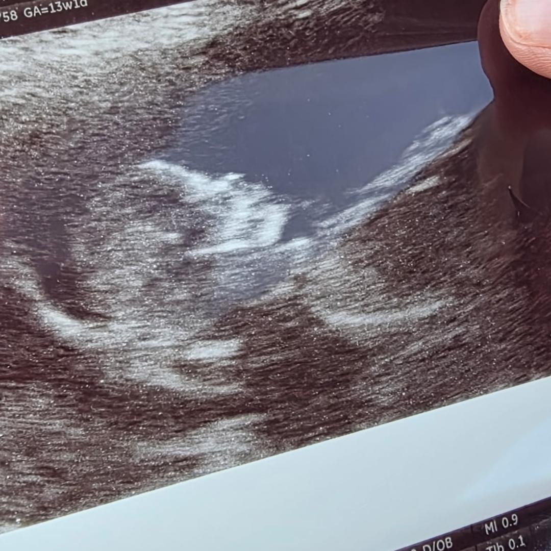 Photo shared by Hayley for their Babylist baby registry.