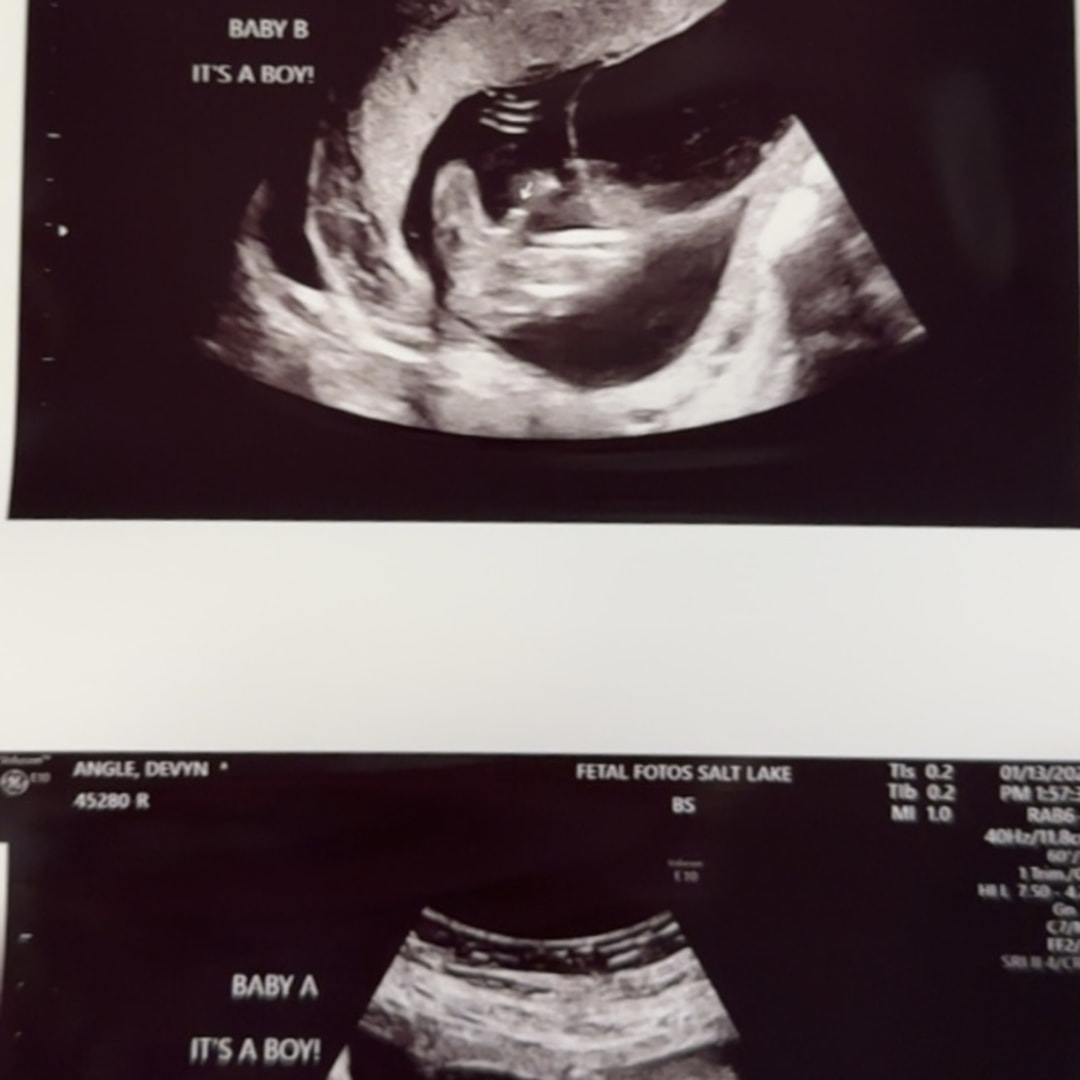 Photo shared by Devyn for their Babylist baby registry.