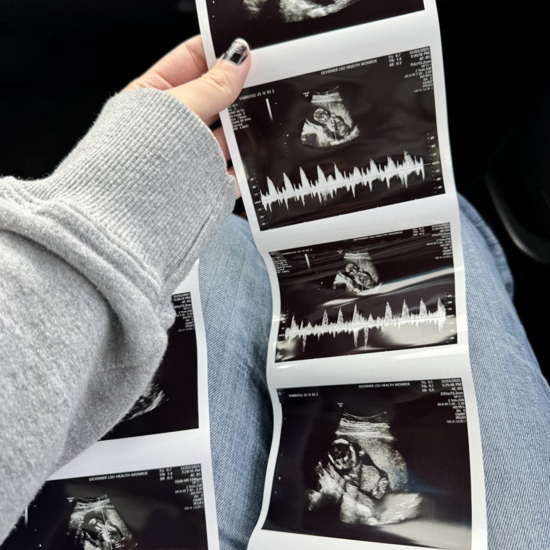 Photo shared by Cherish for their Babylist baby registry.