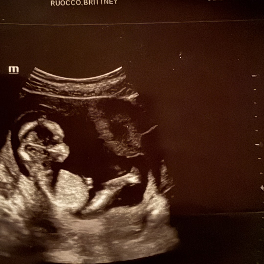 Photo shared by Brittney for their Babylist baby registry.