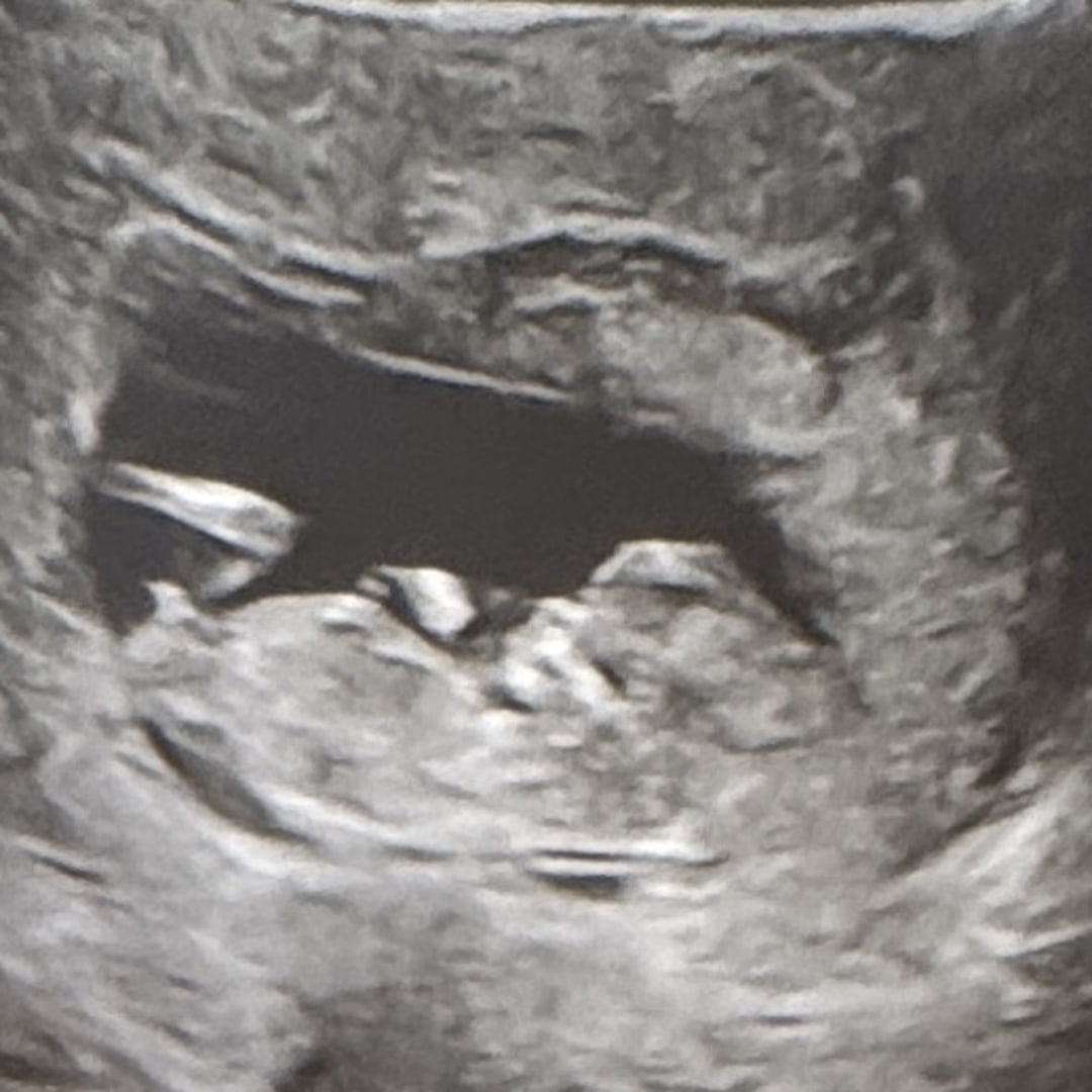 Photo shared by Alexandra for their Babylist baby registry.