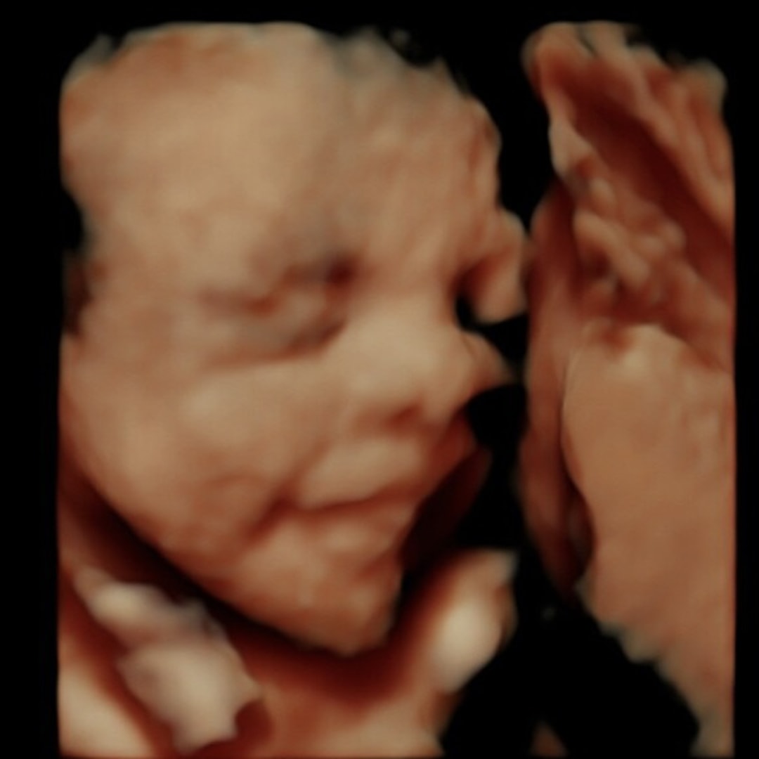 Photo shared by Destiny for their Babylist baby registry.