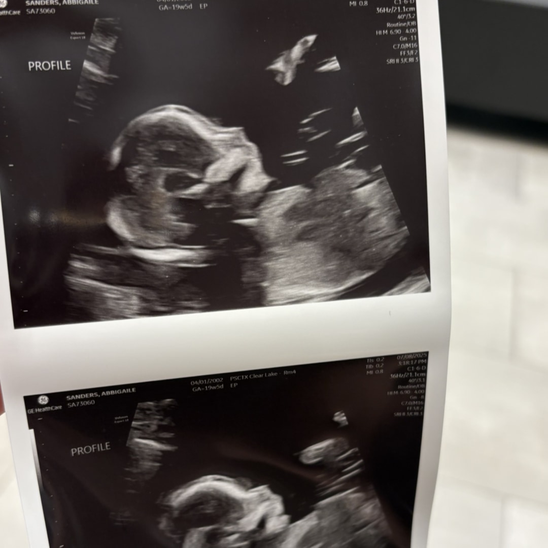 Photo shared by Abbigaile for their Babylist baby registry.