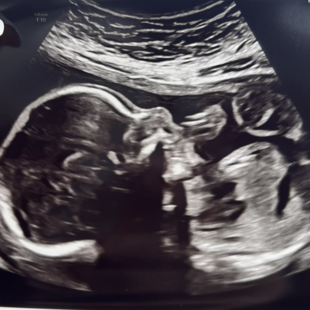 Photo shared by Karoll for their Babylist baby registry.