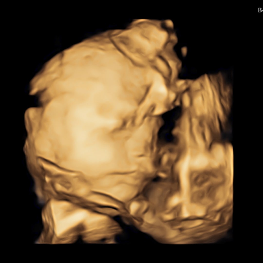 Photo shared by Eleni for their Babylist baby registry.