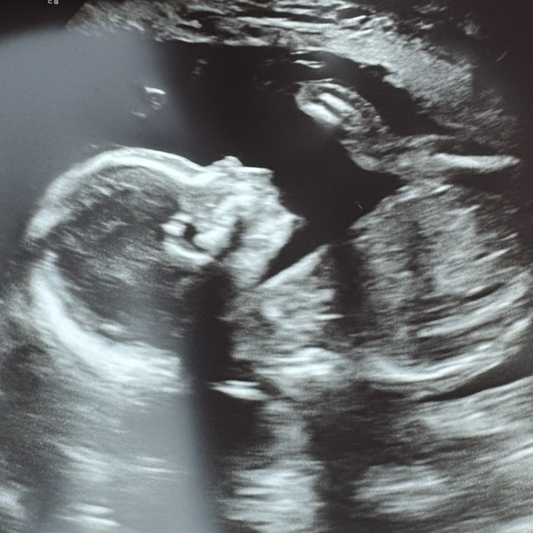 Photo shared by Rebecca for their Babylist baby registry.