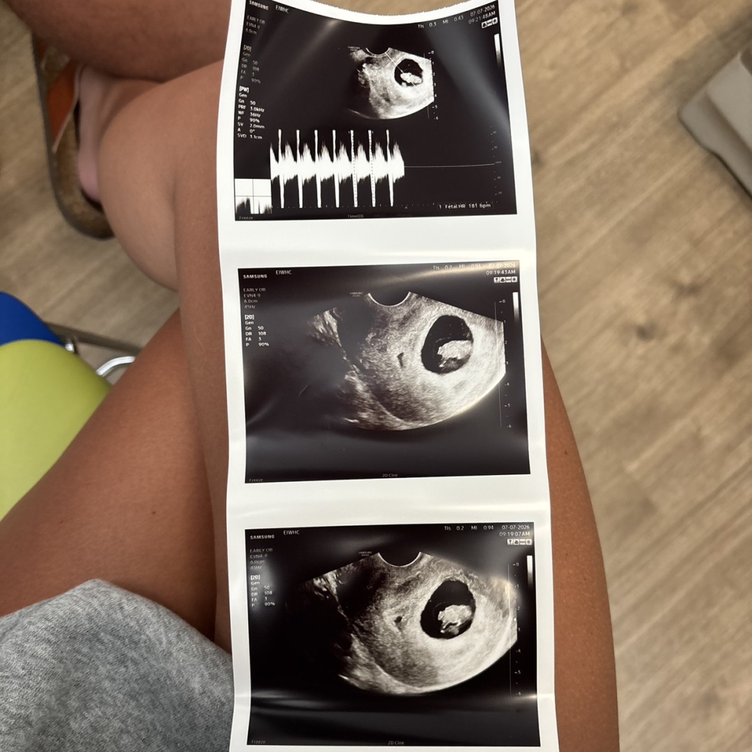 Photo shared by Summer for their Babylist baby registry.