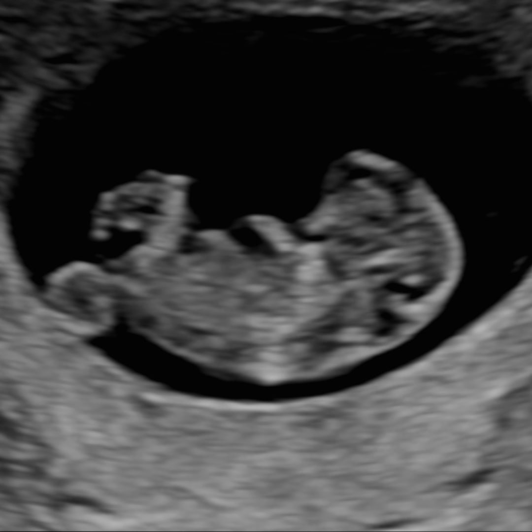 Photo shared by Caitlyn for their Babylist baby registry.