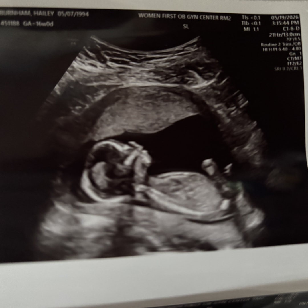 Photo shared by Hailey for their Babylist baby registry.