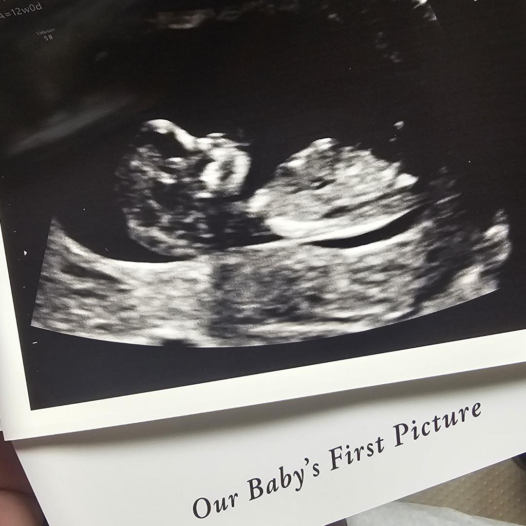 Photo shared by Mars for their Babylist baby registry.