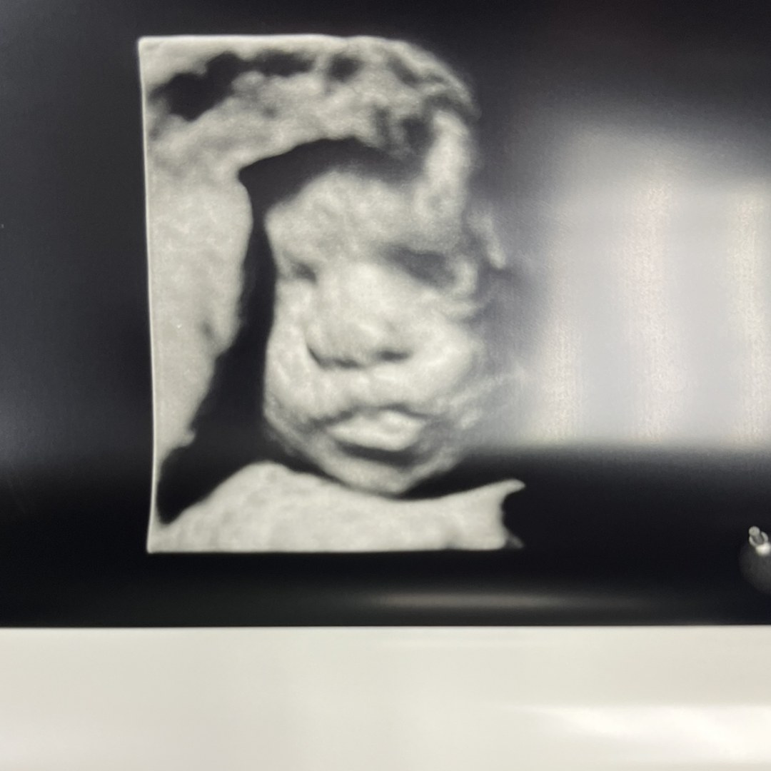 Photo shared by Kayla for their Babylist baby registry.