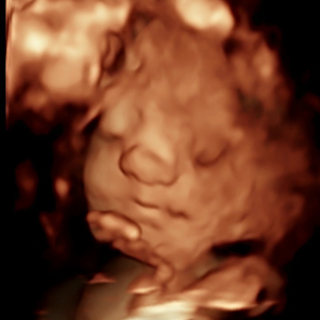 Photo shared by Erin for their Babylist baby registry.