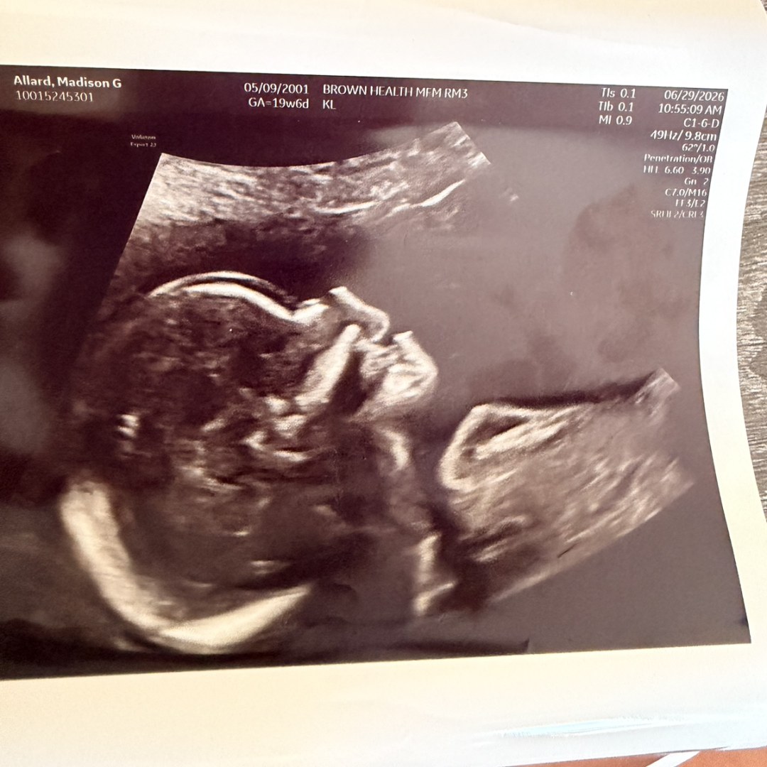 Photo shared by Madison for their Babylist baby registry.