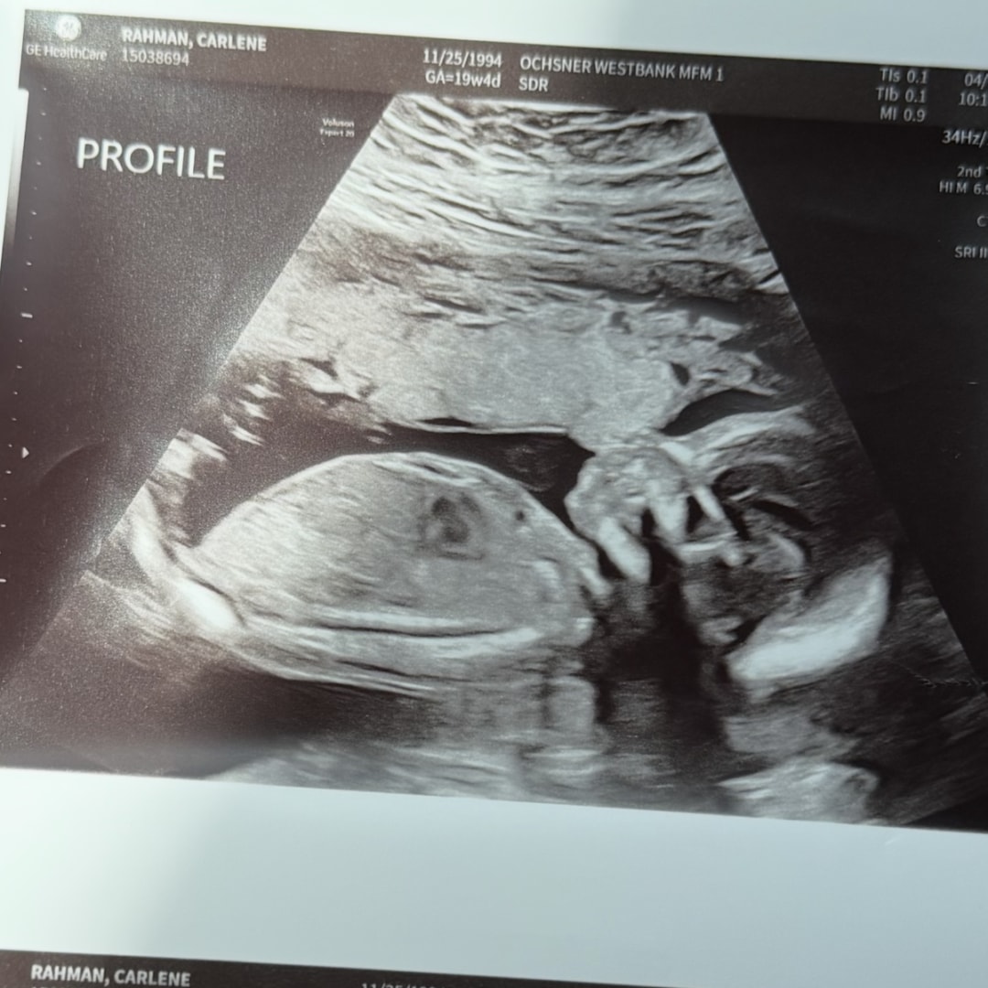 Photo shared by Carlene for their Babylist baby registry.