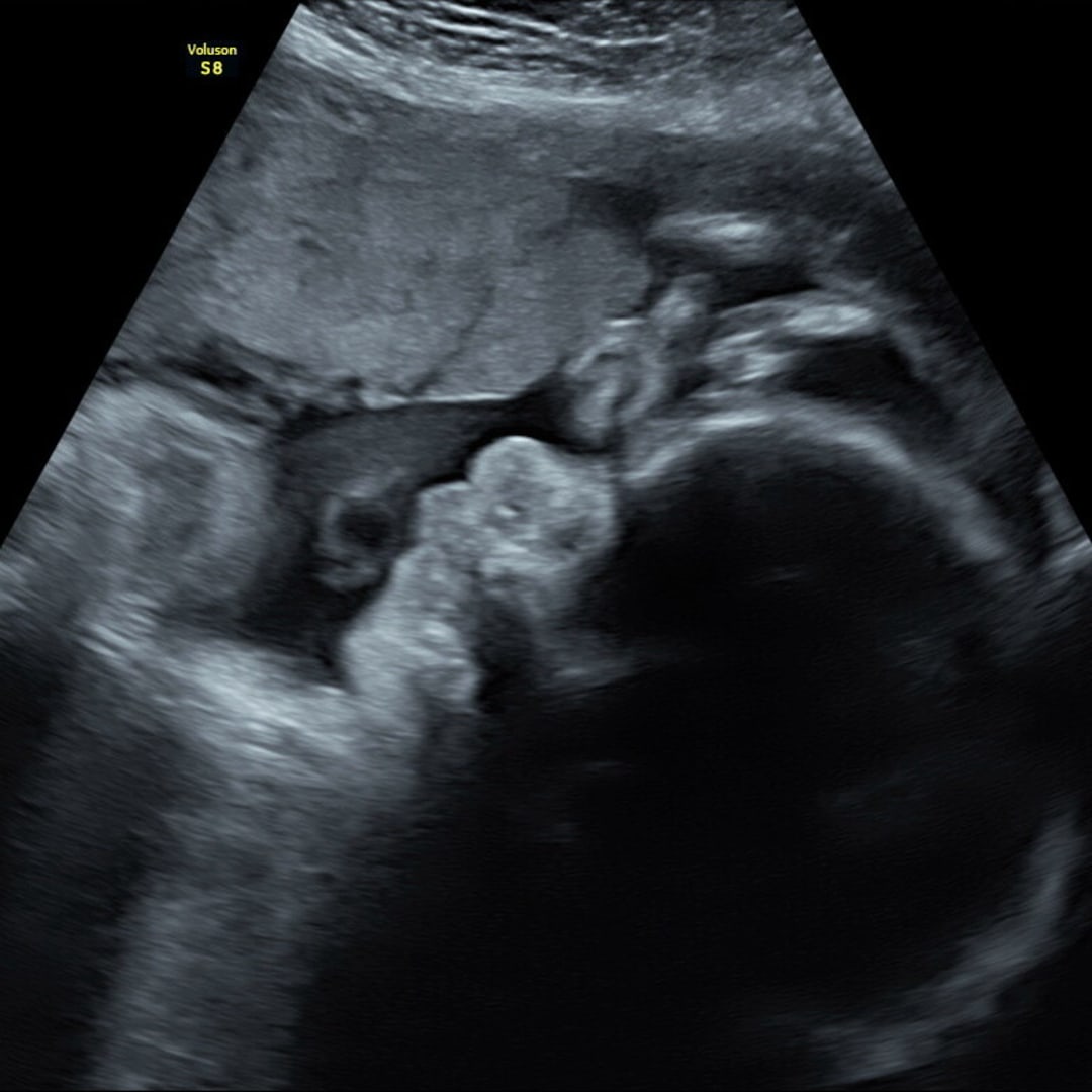 Photo shared by Mercedes for their Babylist baby registry.