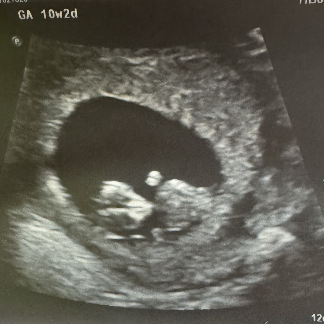 Photo shared by Haley for their Babylist baby registry.