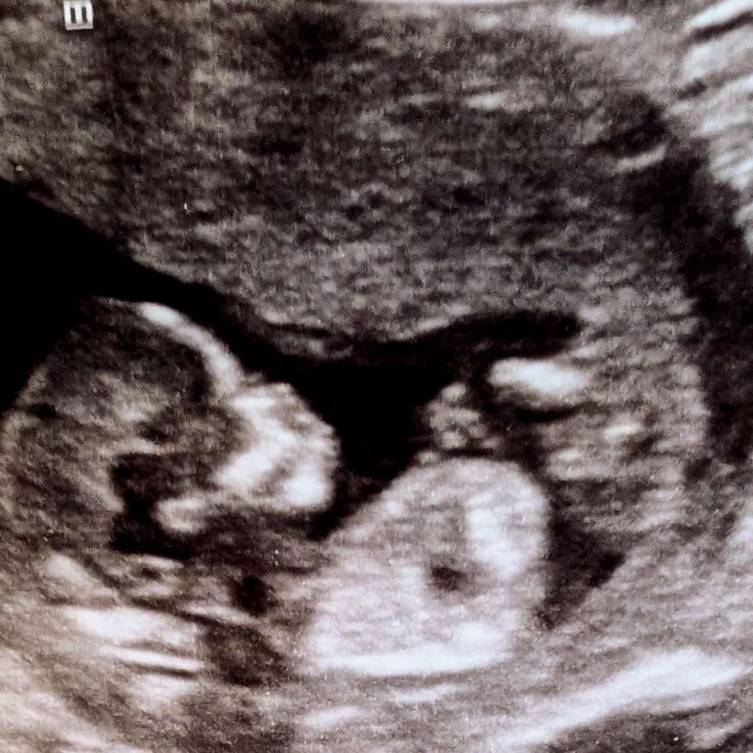 Photo shared by Gabby for their Babylist baby registry.