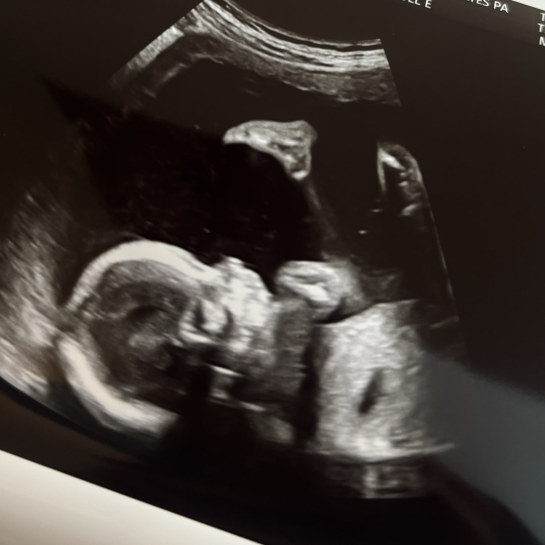 Photo shared by Autumn for their Babylist baby registry.