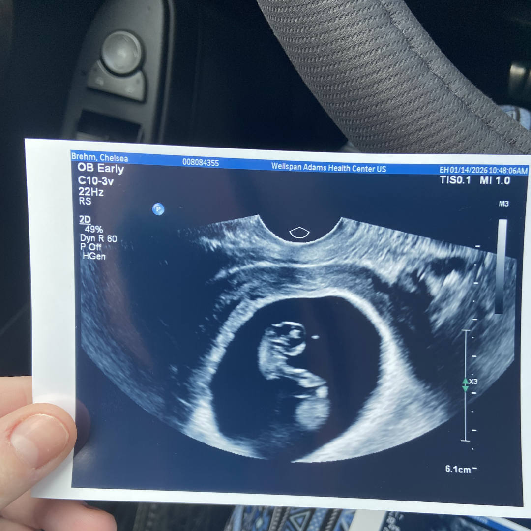 Photo shared by Chelsea for their Babylist baby registry.