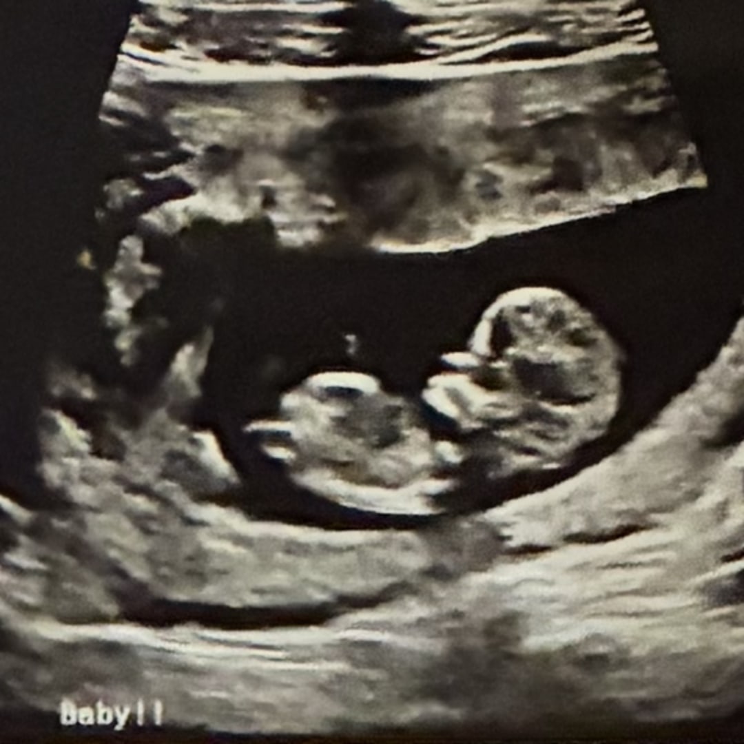 Photo shared by Allayne for their Babylist baby registry.