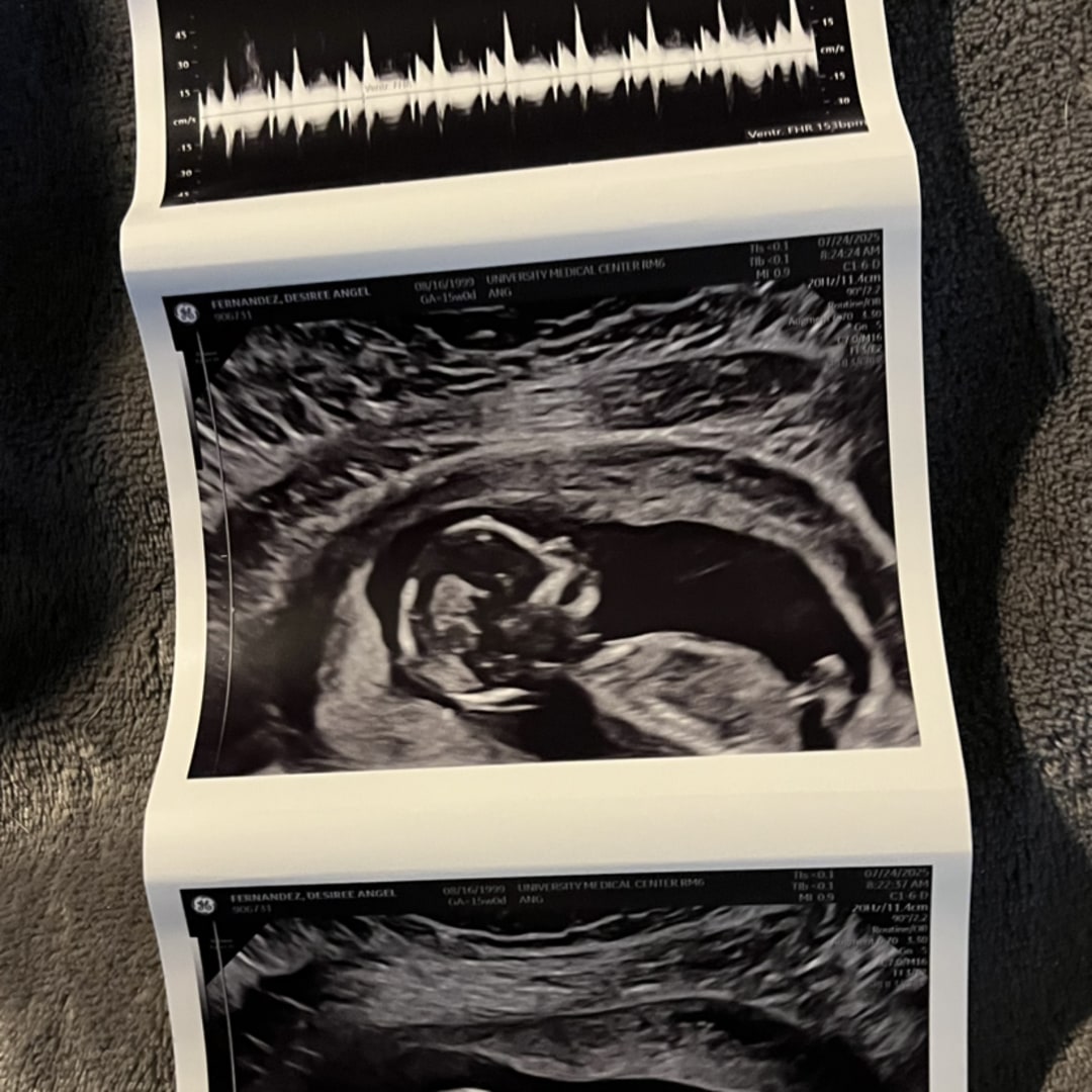 Photo shared by Desiree for their Babylist baby registry.